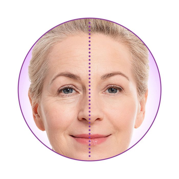 Lishé - Crema para líneas de expresión